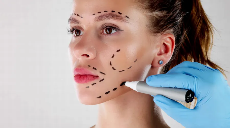 Woman's face with dotted surgical markings for a cosmetic procedure, held by a gloved hand with a marker.